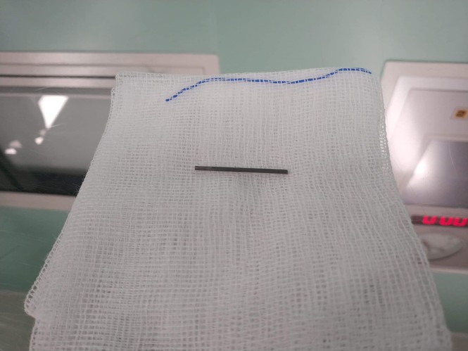 Bút chì cắm vào mắt lệch 1mm, bé gái thoát chết thần kì - ảnh 1