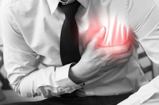 Làm thế nào để phân biệt cơn đau tim và đột quỵ? - ảnh 1
