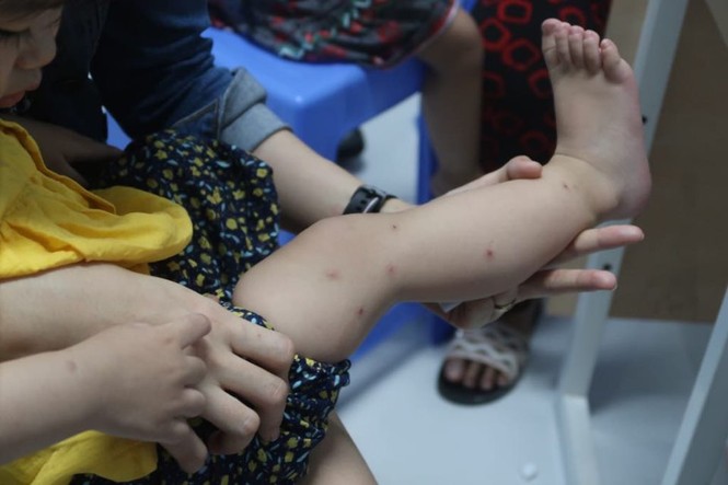 Bác sĩ nhi “điểm mặt” những bệnh thường gặp ở trẻ nhỏ lúc giao mùa - ảnh 3