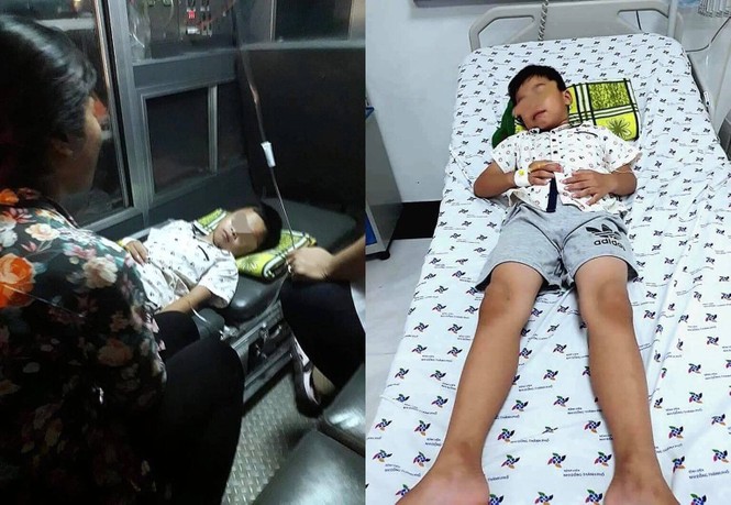 Bác sĩ thắt thòng lọng nội soi gắp que kẹo mút ra khỏi họng em bé - ảnh 1