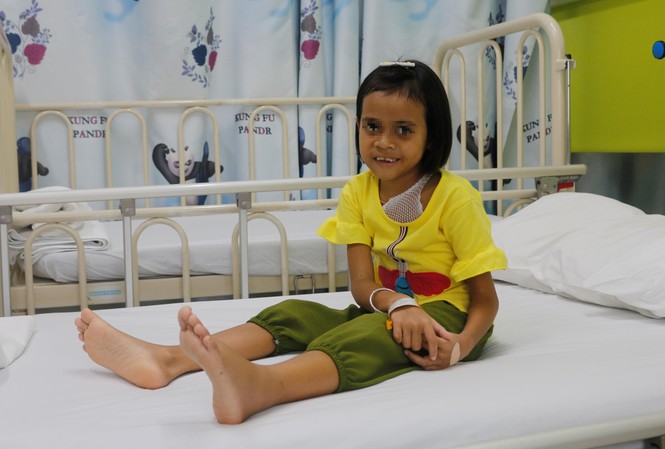 Phẫu thuật thành công cho bé gái dân tộc 8 năm cõng khối bướu trên lưng - ảnh 2
