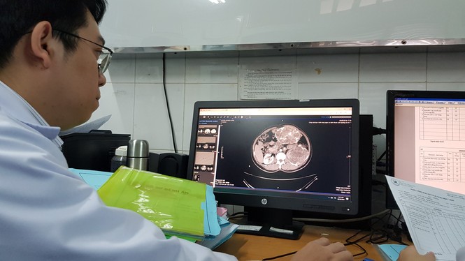 Đi khám vì bụng chướng, bệnh nhân tá hỏa khi bác sĩ “lôi” 3 khối u ra ngoài - ảnh 1