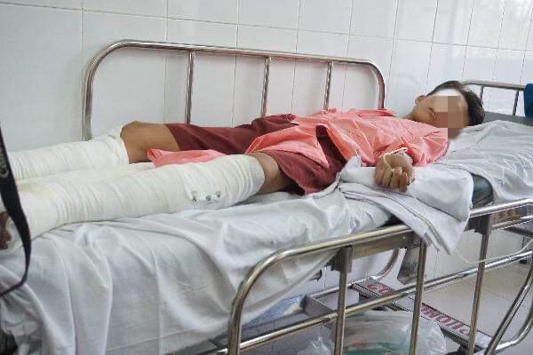 Hút thuốc lá trong lúc đang chiết xăng, 4 người nguy kịch - ảnh 2