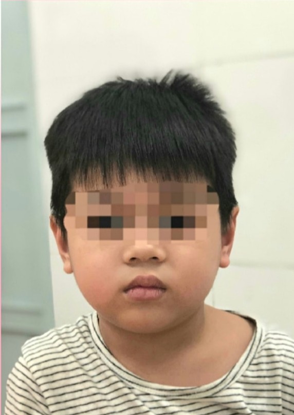 Bé trai bị hóc xưong gà 2 năm không ai biết - ảnh 2