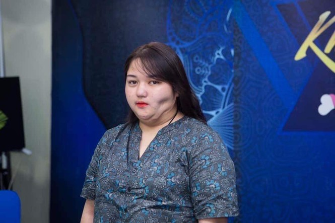 ‘Dựng’ lại khuôn mặt cho cô gái mặt lõm sâu như cái hố - ảnh 1