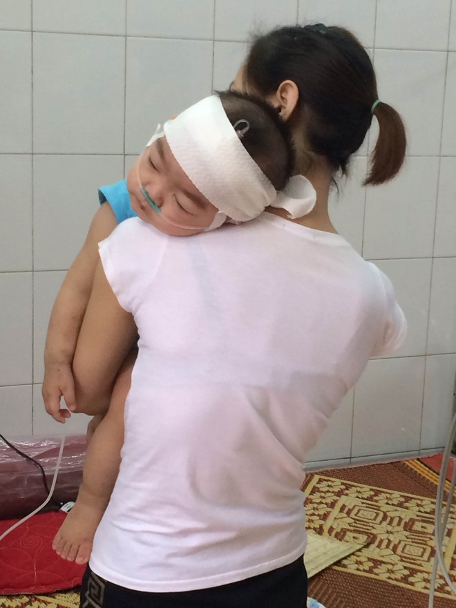 Dịch sởi, nóng chỉ đạo, lạnh thực hiện! - ảnh 1