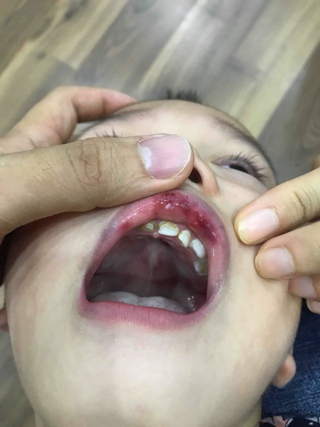 Những vụ giáo viên đánh tới tấp học sinh gây chấn động năm 2019 - ảnh 5