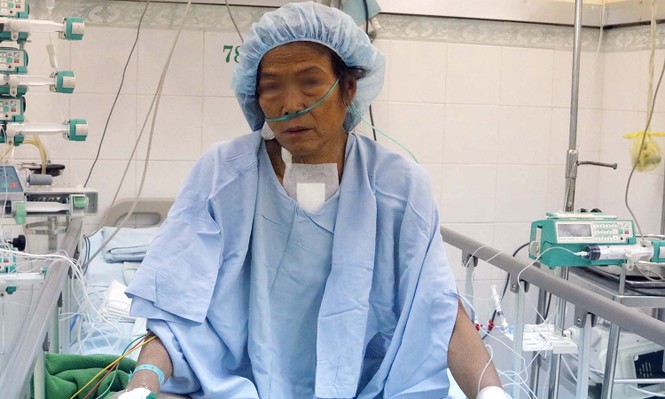 Người phụ nữ ngủ ngồi 3 năm vì quả tim phình gấp đôi bình thường - ảnh 1