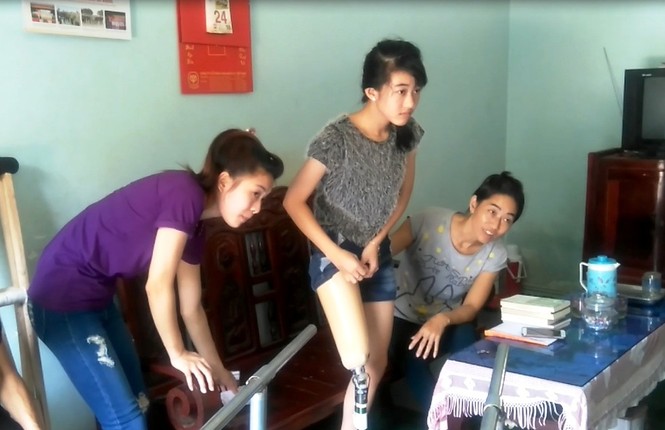 Hà Vi tập quen với cái chân nhân tạo để đi lại thuận tiện