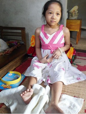 Cô bé xương thuỷ tinh giỏi toán - ảnh 1