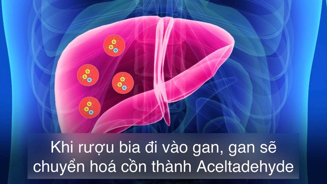 Uống rượu bia thường xuyên: 5 cơ quan nội tạng “bốc hơi” đáng giật mình - ảnh 4