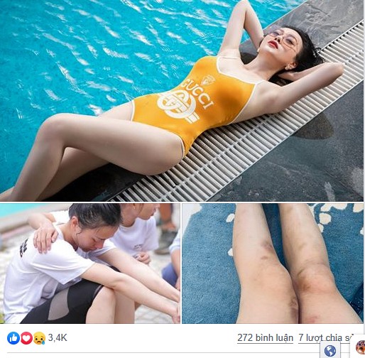 'Quỳnh búp bê' xuất hiện với đôi chân bầm dập sau nửa tháng 'mất tích' - ảnh 1