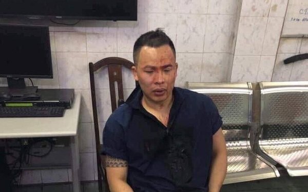 Vũ Khắc Tiệp lại gây 'sốc' với tiết lộ mới về ảnh mặt đầy máu, ngồi đồn công an - ảnh 1