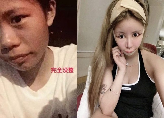 Sợ hãi với 'gương mặt rắn' của mẫu nữ 16 tuổi, đã phẫu thuật thẩm mĩ đến 70 lần - ảnh 3