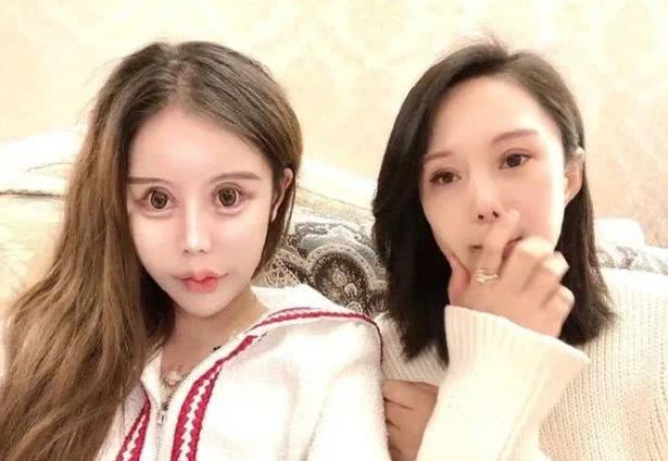 Sợ hãi với 'gương mặt rắn' của mẫu nữ 16 tuổi, đã phẫu thuật thẩm mĩ đến 70 lần - ảnh 2