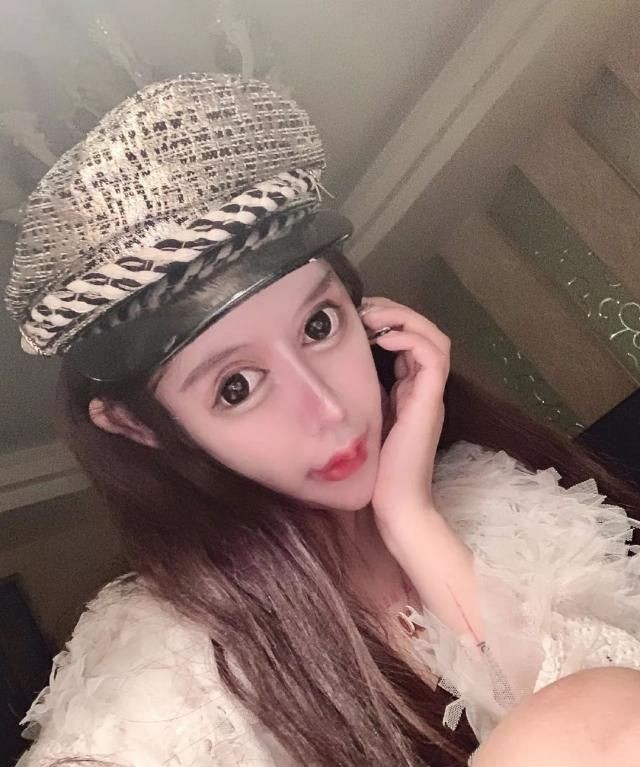Sợ hãi với 'gương mặt rắn' của mẫu nữ 16 tuổi, đã phẫu thuật thẩm mĩ đến 70 lần - ảnh 4