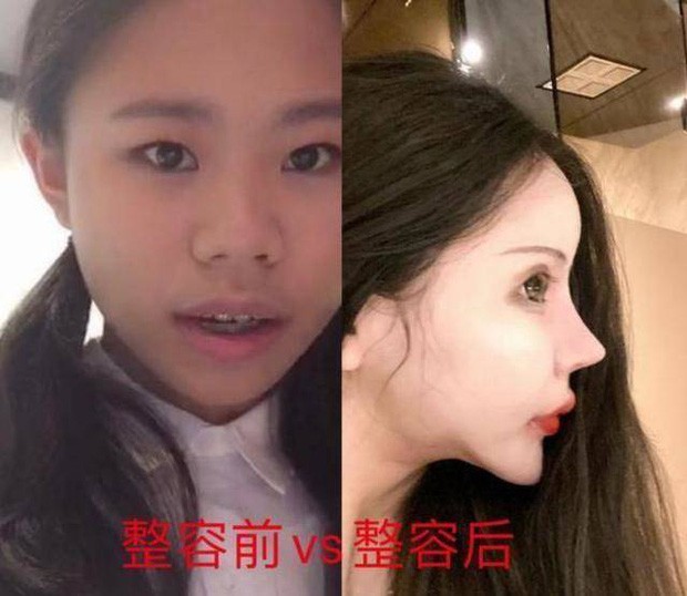 Sợ hãi với 'gương mặt rắn' của mẫu nữ 16 tuổi, đã phẫu thuật thẩm mĩ đến 70 lần - ảnh 5