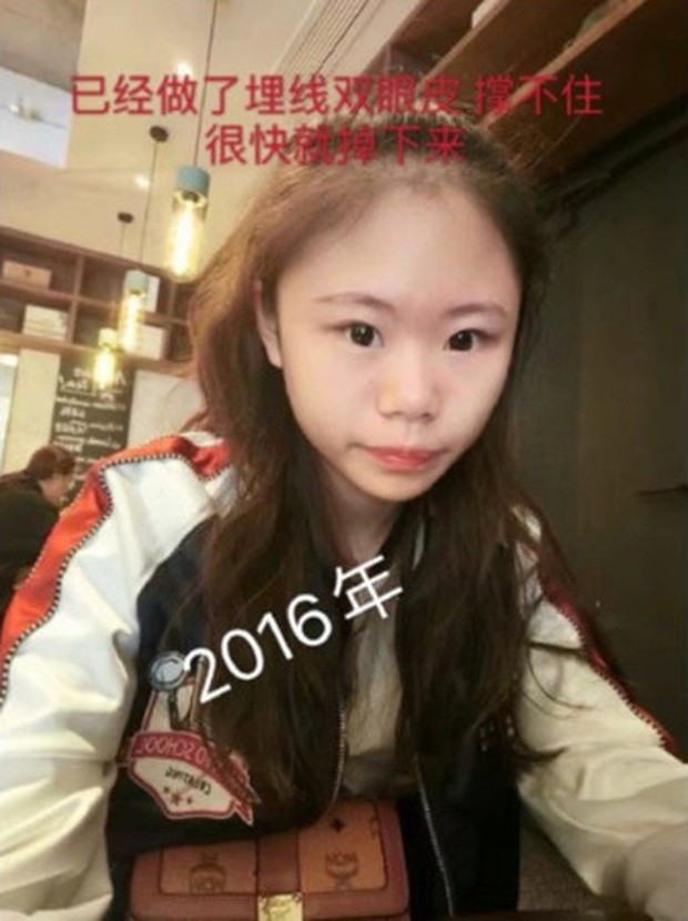 Sợ hãi với 'gương mặt rắn' của mẫu nữ 16 tuổi, đã phẫu thuật thẩm mĩ đến 70 lần - ảnh 6