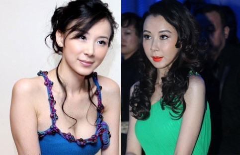 Người đẹp Tiêu Tường của Trung Quốc lộ gương mặt cứng đơ vì thẩm mỹ