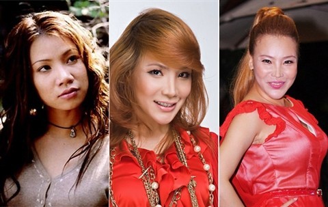 Công nghệ tiên tiến trên thế giới còn vậy, ở Việt Nam, nhiều người không dám đi thẩm mỹ vì sợ mất mạng vì tay nghề của bác sĩ. Nhẹ hơn có thể khiến gương mặt biến dạng và chẳng còn thần sắc như Hồ Quỳnh Hương