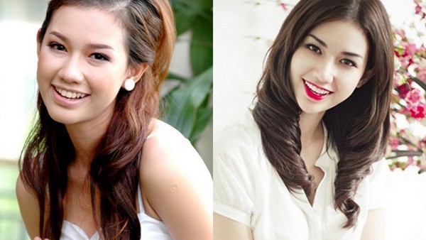 Vốn là hot girl sở hữu vẻ đẹp sắc sảo, mặn mà, Quỳnh Chi dành được giải cao trong cuộc thi Miss Teen 2009. Sau khi cuộc thi kết thúc, nghi án Quỳnh Chi phẫu thuật để