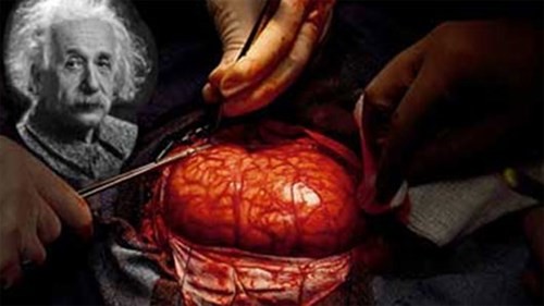 Chuyện lạ có thật về bộ não con người - ảnh 1