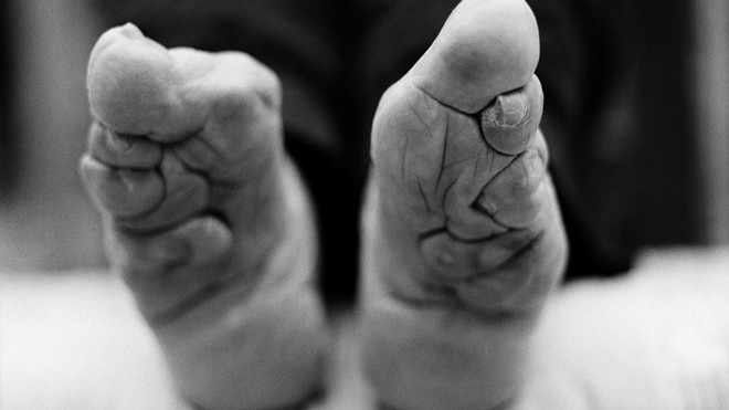 Những nhân chứng sống cuối cùng của tục bó chân - ảnh 3