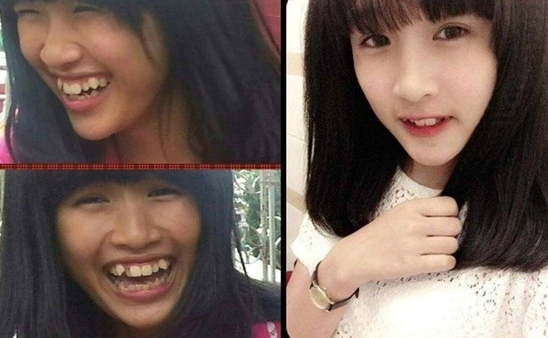 Nhan sắc thiếu nữ trước và sau khi dùng Camera 360 - ảnh 1