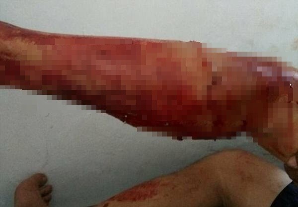 Rồng Komodo tấn công dã man du khách đang chụp ảnh 'tự sướng' - ảnh 1