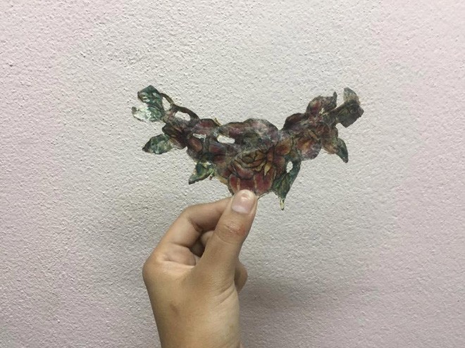 Xóa hình xăm hoa hồng “khủng” trên ngực, nữ sinh viên nhận cái kết đau đớn - ảnh 4