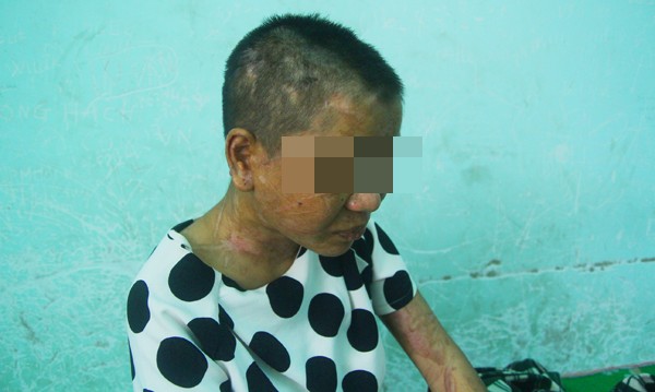 Gương mặt Y Nhiêu trước khi bị nữ gia chủ bạo hành man rợ - ảnh 1