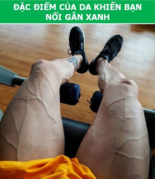 Vì sao bạn “nổi gân xanh” trong khi người khác lại không - ảnh 1
