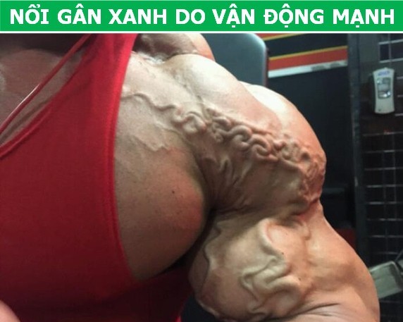 Vì sao bạn “nổi gân xanh” trong khi người khác lại không - ảnh 2