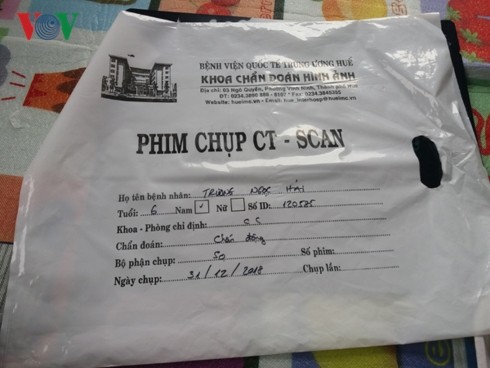 Cô giáo tát học sinh ứa máu tai nghi bị chấn động sọ não - ảnh 1