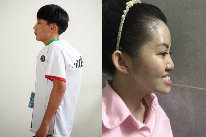 Hành trình giành tấm vé phẫu thuật thẩm mỹ 500 triệu của 31 thí sinh - ảnh 2