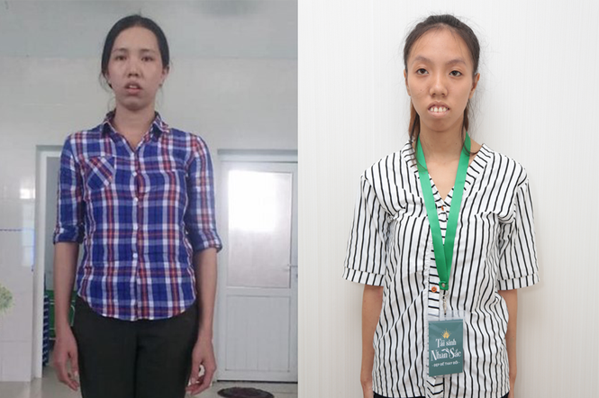 Hành trình giành tấm vé phẫu thuật thẩm mỹ 500 triệu của 31 thí sinh - ảnh 4