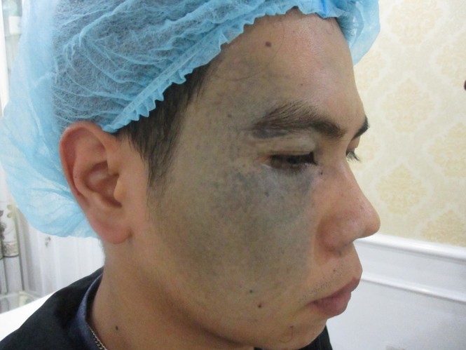 Bệnh viện thẩm mỹ Đông Á đồng hành cùng các hoàn cảnh khó khăn điều trị chàm bớt - ảnh 1
