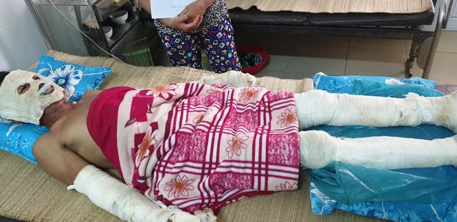 Phát nổ do rò rỉ khí ga trong đám tang, 5 người bỏng nặng - ảnh 2