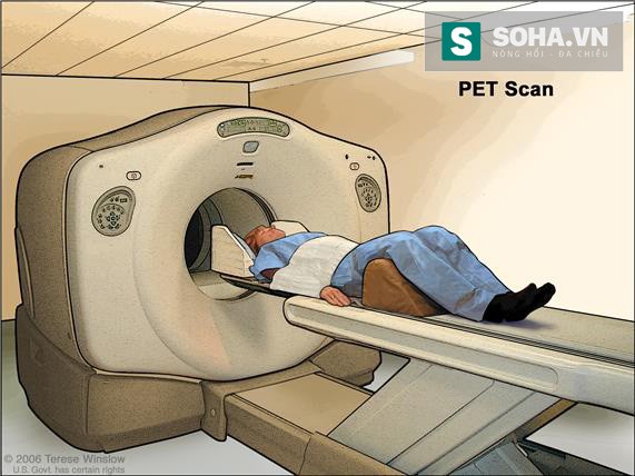 Có thể dùng PET Scan để phát hiện sớm ung thư không? - ảnh 1