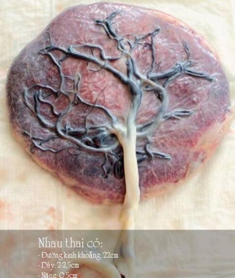Thuốc làm từ nhau thai người: Đại bổ hay độc hại? - ảnh 1