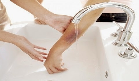 Cụ ông 68 tuổi 'chết oan' vì đến nhà thày lang chữa bỏng - ảnh 1