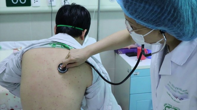 Cực hiếm: Việt Nam phát hiện người lớn bị ho gà - ảnh 1