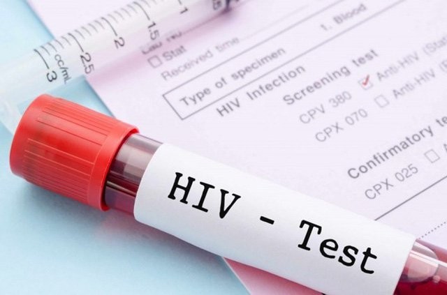 Khi có kết quả xét nghiệm HIV dương tính, người bệnh được thông báo thế nào? - ảnh 1