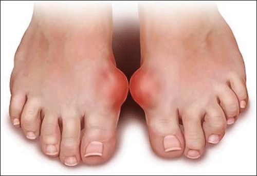 Dấu hiệu ở chân cảnh báo bệnh cực kỳ nguy hiểm, khám ngay kẻo muộn - ảnh 2