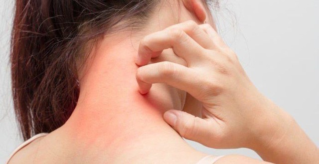 Dấu hiệu sớm cảnh báo ung thư gan, đừng bỏ qua kẻo ân hận mấy cũng muộn - ảnh 4