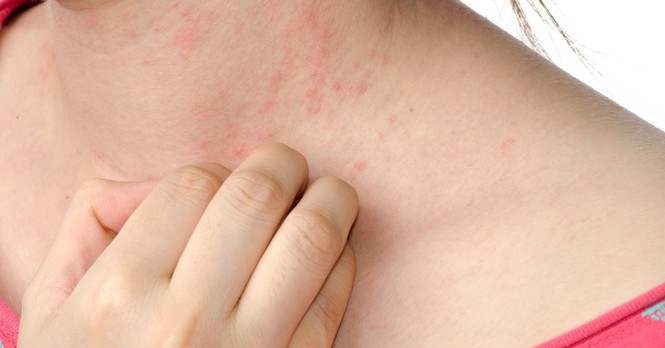 Hàu: Cực tốt và cực độc, biết mà tránh khi ăn khỏi 'rước họa vào thân' - ảnh 4