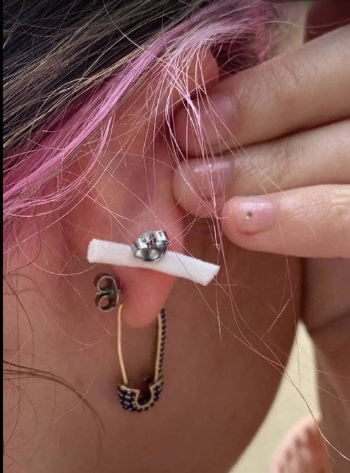 Tai nạn kinh dị của TikToker nổi tiếng: Đi bấm lỗ tai, bị bấm luôn quai khẩu trang vào tai - ảnh 5