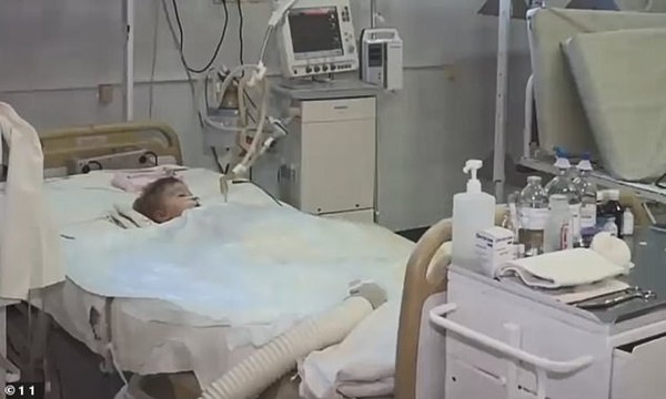 Bố mẹ mải tổ chức tiệc sinh nhật, cậu bé 2 tuổi bị chó nhà tấn công, nhai nát nhiều bộ phận - ảnh 1