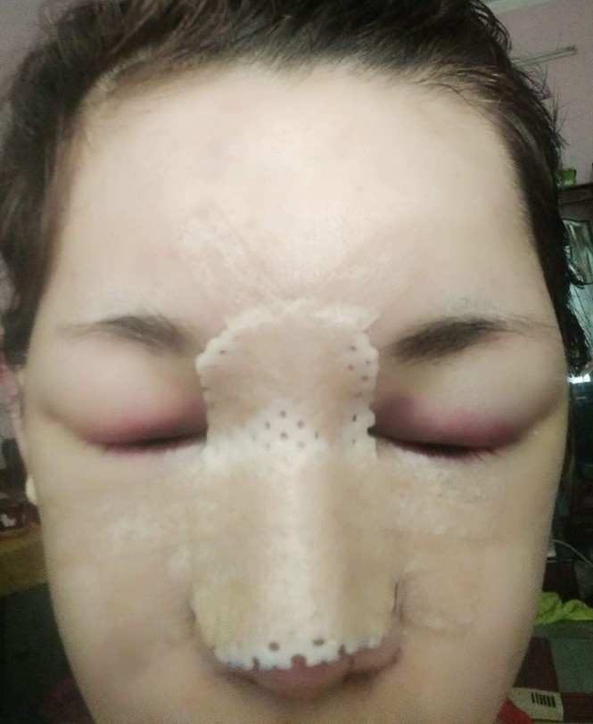Chia tay vì bị chê bai ngoại hình, cô gái