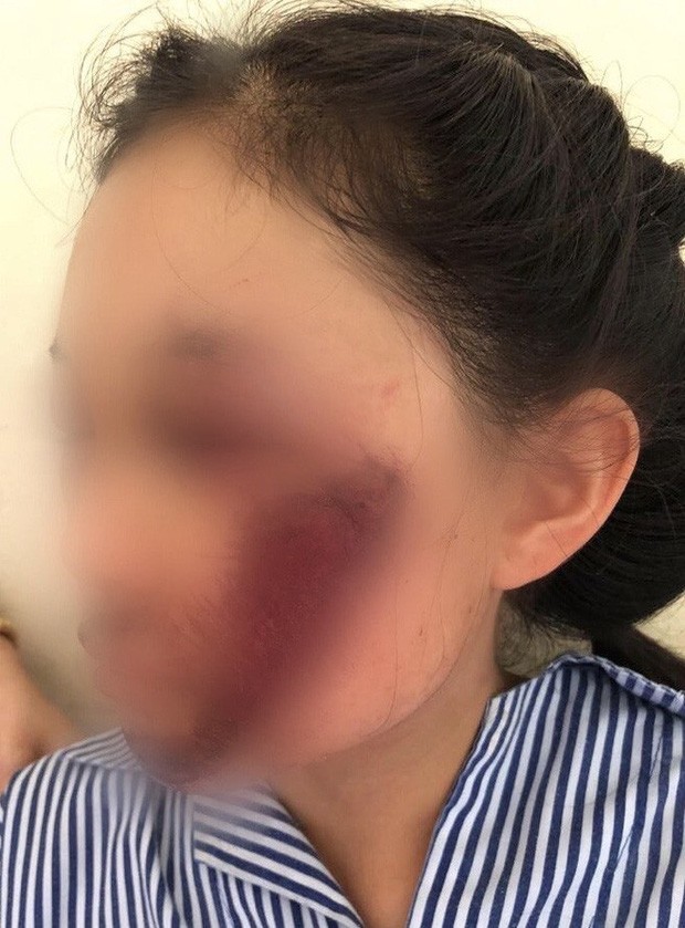Hiểm họa rình rập từ những trang phục chống nắng của hội chị em khi tham gia giao thông - ảnh 1